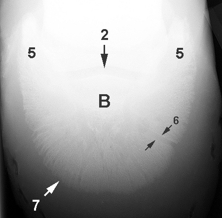 Radiograph of the Dorsoplantar view