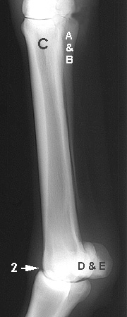 Radiograph of the Lateral view