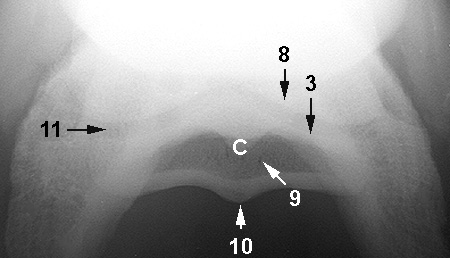 Radiograph of the Palmar(plantar)oproximal-palmar(plantar)odistal oblique view