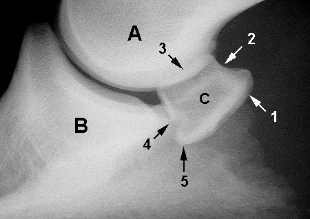 Radiograph of the Lateral view