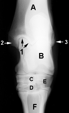 Radiograph of the Dorsoplantar view