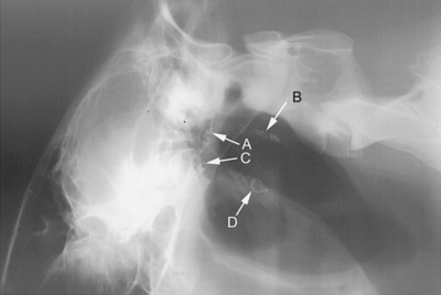 guttural pouch radiograph