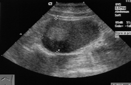 Mesenteric Lymph Node