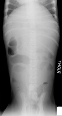 Ventrodorsal Radiograph