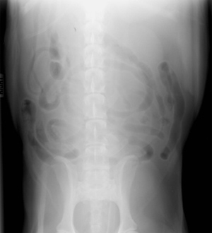 Figure 2: Ventrodorsal Caudal Abdomen