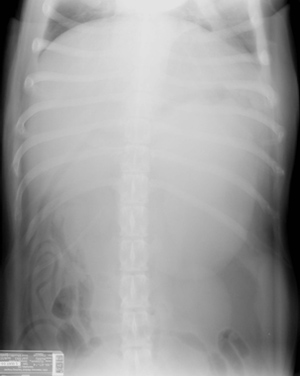 Figure 1: Ventrodorsal Cranial Abdomen