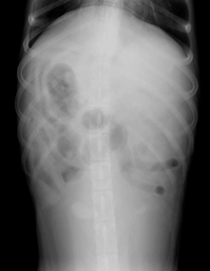 Abdomen: cranial VD view