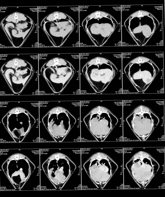 Thoracic CT