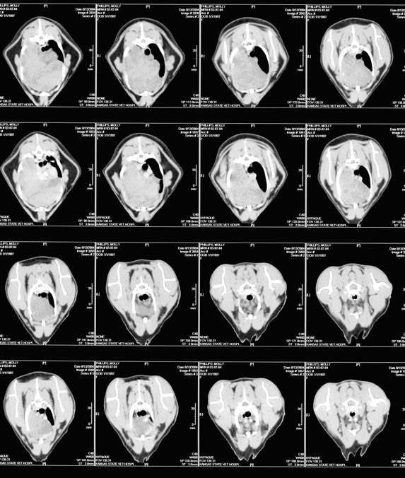 Thoracic CT