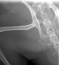 Figure 2. Oblique pelvis