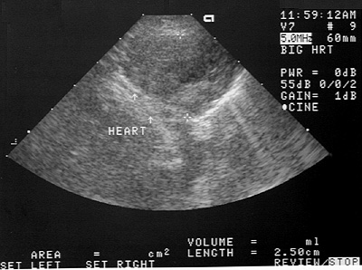 Ultrasonographic image of the pulmonary mass