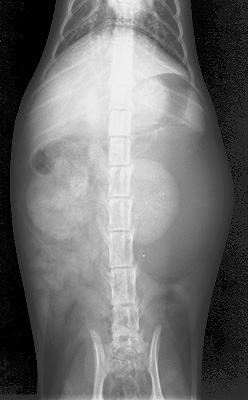 Nephrogenic and pyelogenic phases of an intravenous pyelogram