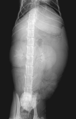 Nephrogenic and pyelogenic phases of an intravenous pyelogram