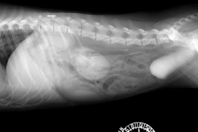 Radiograph of the Intravenous pyelogram - pyelogenic phase - right lateral view