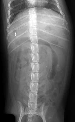 Radiograph of the Ventrodorsal view