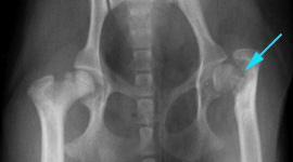 Findings consistent with chronic left femoral neck fracture