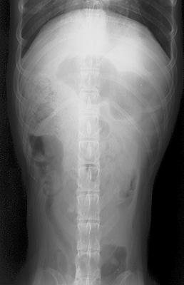 Radiograph of the Ventrodorsal view