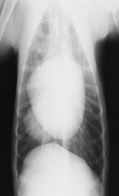 Radiograph of the Ventrodorsal view