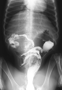 Radiograph of the Dorsoventral view at 17.5 hours
