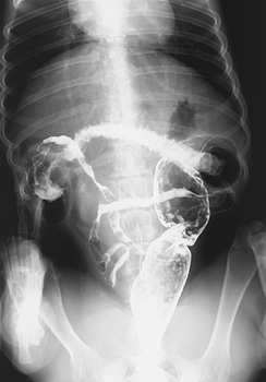 Radiograph of the Dorsoventral view at 22 hours