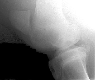 Radiograph of the Lateral view - right stifle
