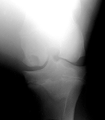 Radiograph of the Craniocaudal view - right stifle