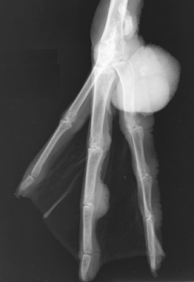 Radiograph of the Right DMPL oblique view