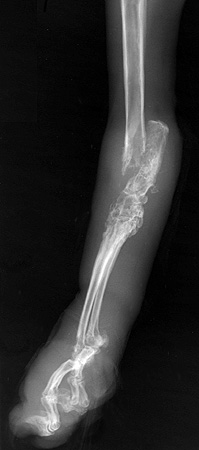 Radiograph of the Left lateral view