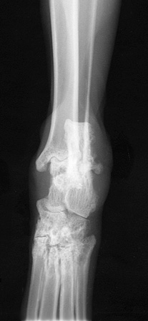 Radiograph of the Right craniocaudal view