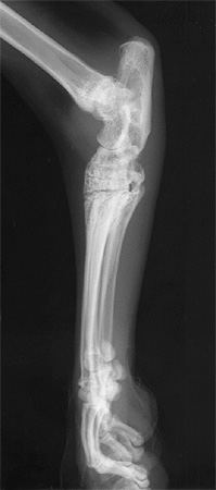 Radiograph of the Right lateral view