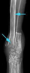 Radiograph of the Craniocaudal view of the left tarsus