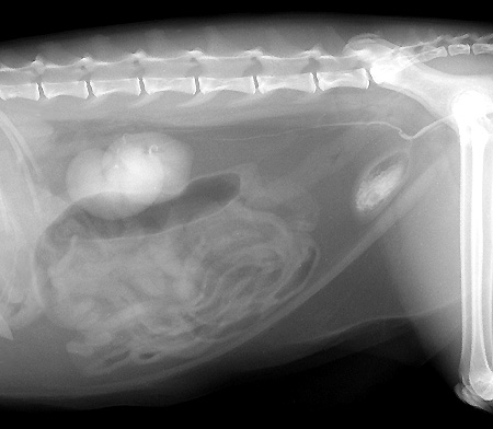 Radiograph of the Lateral View - Nephrogenic Phase