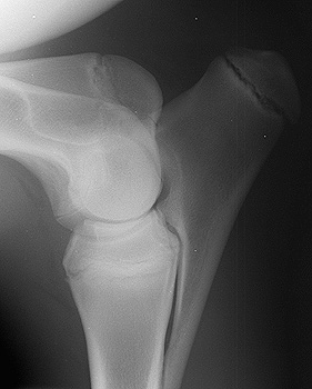 Radiograph of the Right Lateral View - Right Elbow