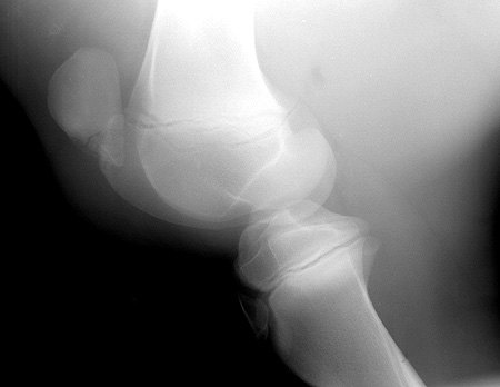 Radiograph of the Lateral View of Left Stifle
