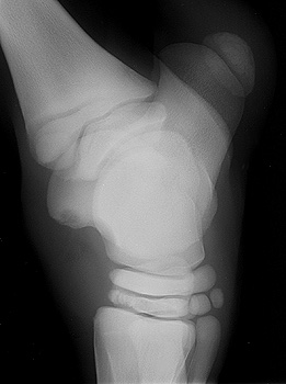 Radiograph of the Left lateral view of left tarsus
