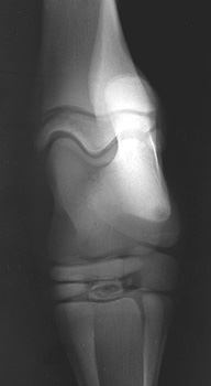 Radiograph of the Craniocaudal view of left tarsus