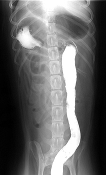 Ventrodorsal view - partial barium enema radiograph