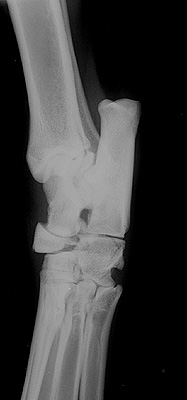 Radiograph of the DLPM view